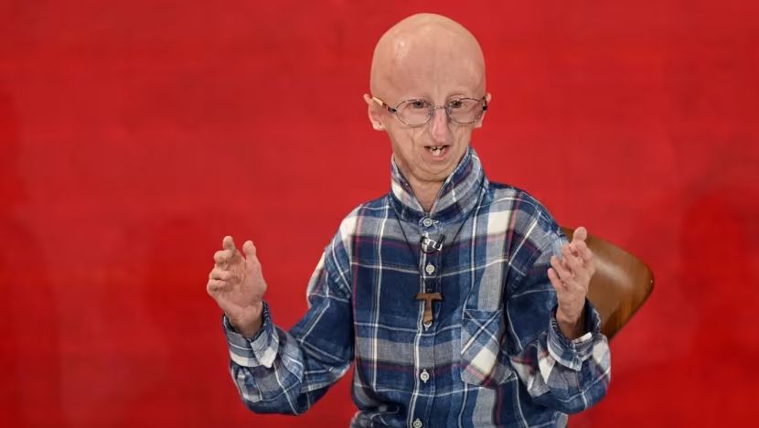 Sammy Basso, Progeria Survivor, Dies At 28